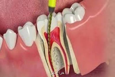 بررسی عصب كشی، ایمپلنت دندان و دندان مصنوعی