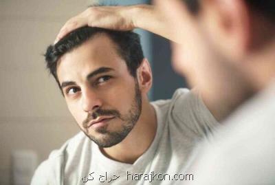 چطور می توان ریزش مو را درمان كرد؟